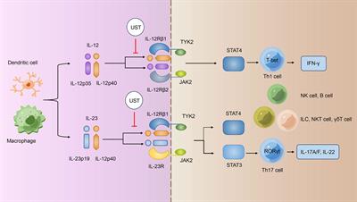 Research progress of Ustekinumab in the treatment of inflammatory bowel disease